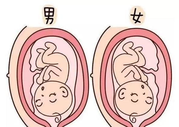 即孕妇妊娠纹窄的多会生男孩,宽的多会生女孩.