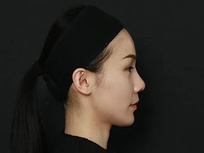 面相分析嘴唇尖的人