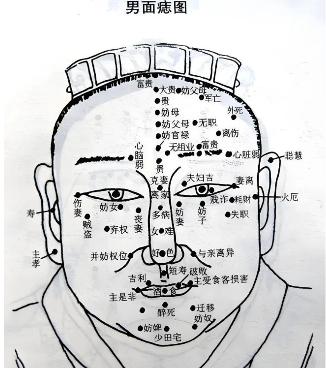 身痣多吉，面痣多忌：男人痣相全身32处吉凶